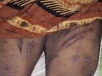 KontraS Sumut Minta Mabes Usut Sipil yang Perintah Oknum TNI Aniaya Warga di Langkat