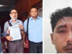 Pukul Pegawai Hingga Berdarah, Oknum Pejabat BRI Palas Dilapor ke Polres Palas