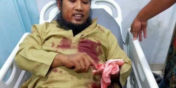 Polda Aceh Dalami Motif Pelaku Penikaman Ustaz Muhammad Zaid  di Aceh Tenggara