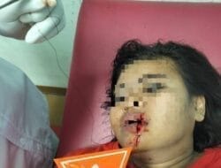 Tagih Hutang, Bibir RY Pekerja Cafe Dibacok Temannya