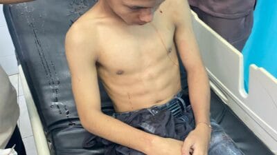 Atlet Tarung Derajat Peraih Medali Emas Jadi Korban Geng Motor di Kisaran, Pengprov Kodrat Sumut Minta Polisi Bertindak Tegas