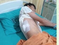 Kera Liar dari Hutan Bakau Sei Babalan Serang Warga, 4 Orang Luka Serius