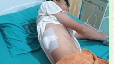 Kera Liar dari Hutan Bakau Sei Babalan Serang Warga, 4 Orang Luka Serius