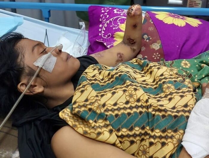 Dugaan Malapraktik RS Permata Madina, Keluarga RSH Layangkan Somasi