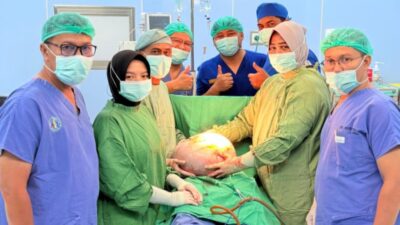 Tim Dokter RSUD Dr. H. Yuliddin Away (RSUDYA) Tapaktuan Berhasil Angkat Kista Ovarium Seberat 19 Kg